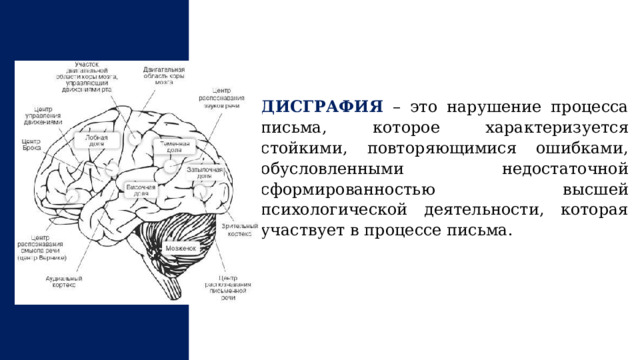 ДИСГРАФИЯ – это нарушение процесса письма, которое характеризуется стойкими, повторяющимися ошибками, обусловленными недостаточной сформированностью высшей психологической деятельности, которая участвует в процессе письма.  