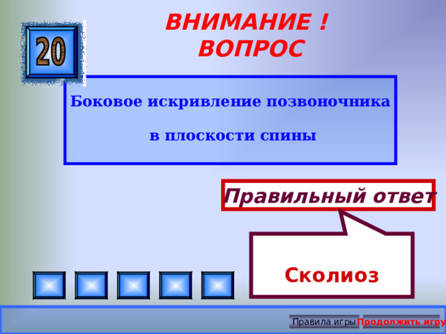  Сколиоз ВНИМАНИЕ ! ВОПРОС Боковое искривление позвоночника  в плоскости спины Правильный ответ Правила игры Продолжить игру 