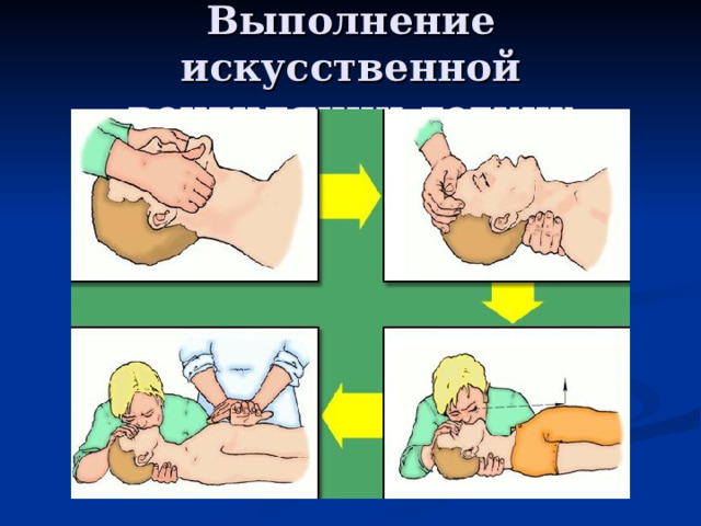 Выполнение искусственной вентиляции легких 