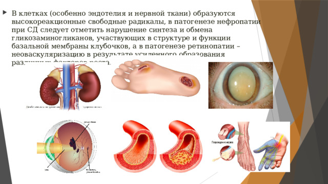 В клетках (особенно эндотелия и нервной ткани) образуются высокореакционные свободные радикалы, в патогенезе нефропатии при СД следует отметить нарушение синтеза и обмена гликозаминогликанов, участвующих в структуре и функции базальной мембраны клубочков, а в патогенезе ретинопатии – неоваскуляризацию в результате усиленного образования различных факторов роста. 
