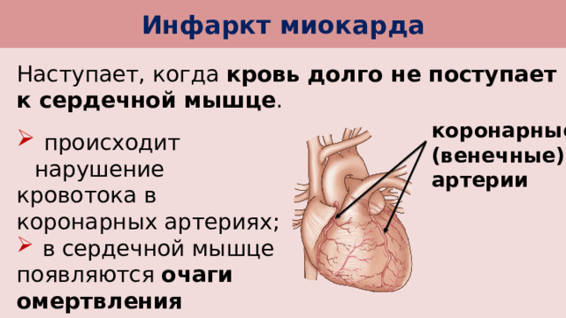 Инфаркт миокарда Наступает, когда кровь долго не поступает к сердечной мышце . коронарные (венечные) артерии  происходит нарушение кровотока в коронарных артериях;  в сердечной мышце появляются очаги омертвления (некрозы). 