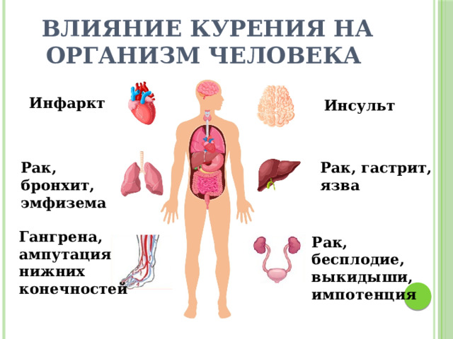 Влияние курения на организм человека Инфаркт Инсульт Рак, бронхит, эмфизема Рак, гастрит, язва Гангрена, ампутация нижних конечностей Рак, бесплодие, выкидыши, импотенция 