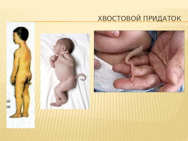 Хвостовой придаток 