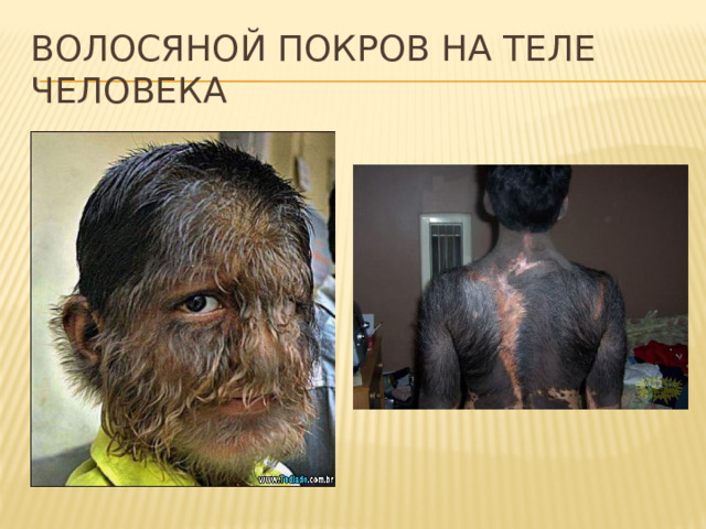 Волосяной покров на теле человека 