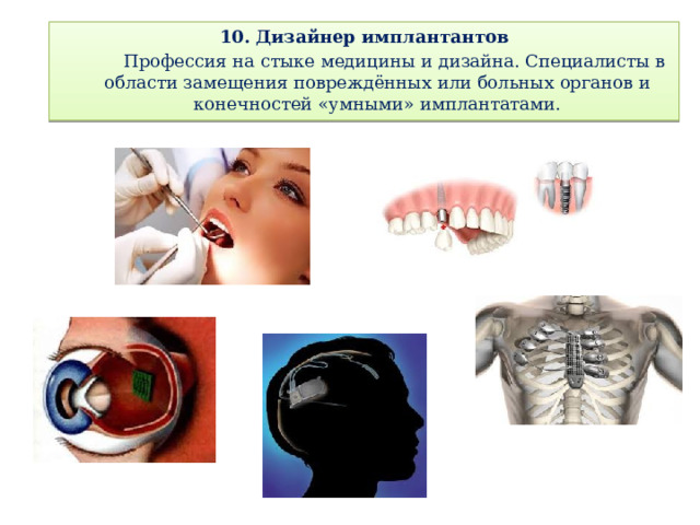 10. Дизайнер имплантантов   Профессия на стыке медицины и дизайна. Специалисты в области замещения повреждённых или больных органов и конечностей «умными» имплантатами. 