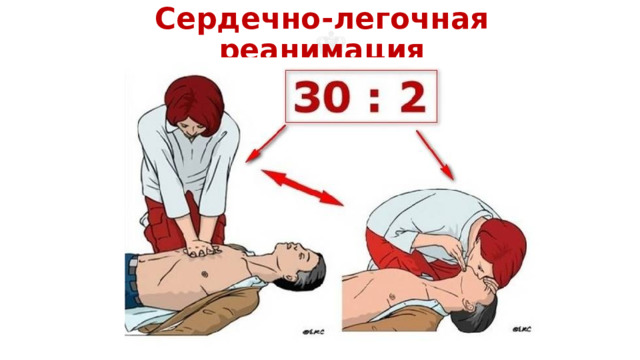 Сердечно-легочная реанимация 