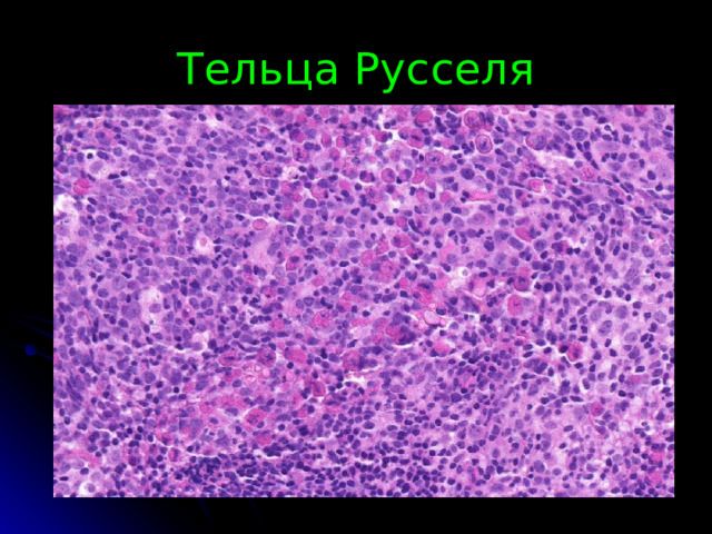 Тельца Русселя 