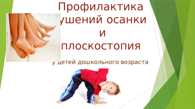 Профилактика нарушений осанки  и  плоскостопия у детей дошкольного возраста 