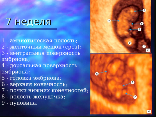 7 неделя 1 - амниотическая полость;  2 - желточный мешок (срез);  3 - вентральная поверхность эмбриона;  4 - дорсальная поверхность эмбриона;  5 - головка эмбриона;  6 - верхняя конечность;  7 - почки нижних конечностей;  8 - полость желудочка;  9 - пуповина.  