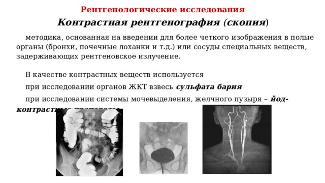 Рентгенологические исследования Контрастная  рентгенография  ( скопия ) методика, основанная на введении для более четкого изображения в полые органы (бронхи, почечные лоханки и т.д.) или сосуды специальных веществ, задерживающих рентгеновское излучение. В качестве контрастных веществ используется при исследовании органов ЖКТ взвесь сульфата бария при исследовании системы мочевыделения, желчного пузыря – йод-контрастные препараты . 