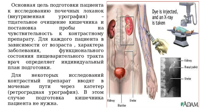 Основная цель подготовки пациента к исследованию почечных лоханок (внутривенная урография) – тщательное очищение кишечника и постановка пробы на чувствительность к контрастному препарату. Для каждого пациента в зависимости от возраста , характера заболевания, функционального состояния пищеварительного тракта врач определяет индивидуальный план подготовки. Для некоторых исследований контрастный препарат вводят в мочевые пути через катетер (ретроградная урография). В этом случае подготовка кишечника пациента не нужна. 