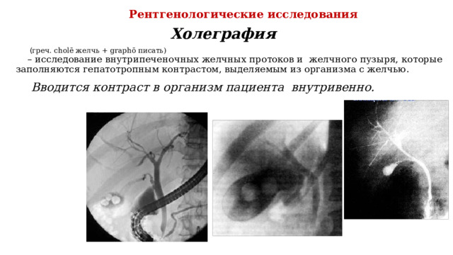 Рентгенологические исследования Холеграфия   ( греч. cholē желчь + graphō писать) – исследование внутрипеченочных желчных протоков и желчного пузыря, которые заполняются гепатотропным контрастом, выделяемым из организма с желчью.   Вводится контраст в организм пациента внутривенно. 