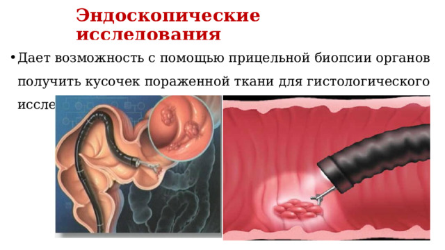 Эндоскопические исследования Дает возможность с помощью прицельной биопсии органов получить кусочек пораженной ткани для гистологического исследования; 