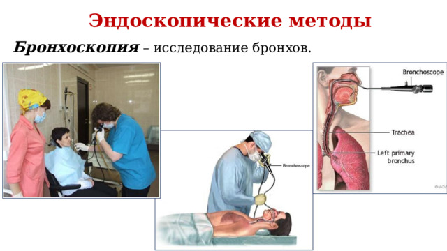 Эндоскопические методы Бронхоскопия  – исследование бронхов. 