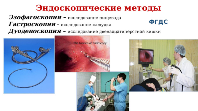 Эндоскопические методы Эзофагоскопия – исследование пищевода  Гастроскопия  –  исследование желудка  Дуоденоскопия – исследование двенадцатиперстной кишки ФГДС 