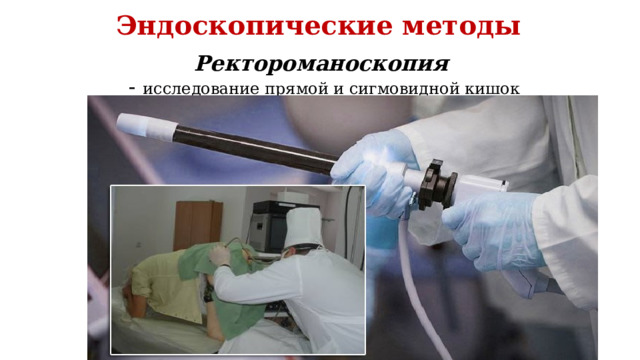 Эндоскопические методы Ректороманоскопия  - исследование прямой и сигмовидной кишок 