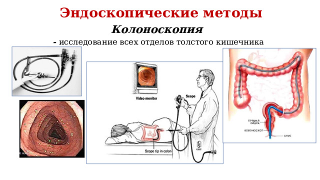 Эндоскопические методы Колоноскопия   - исследование всех отделов толстого кишечника 