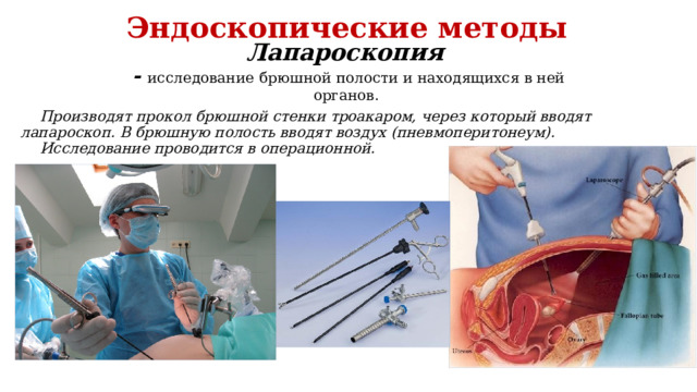 Эндоскопические методы Лапароскопия  - исследование  брюшной полости и находящихся в ней органов . Производят прокол брюшной стенки троакаром, через который вводят лапароскоп. В брюшную полость вводят воздух (пневмоперитонеум). Исследование проводится в операционной. 