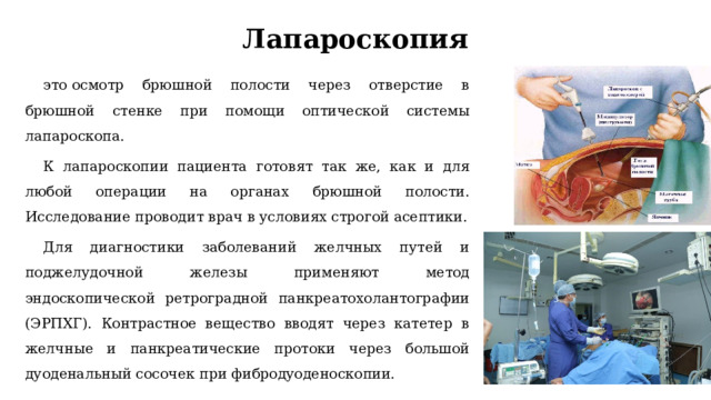 Лапароскопия это осмотр брюшной полости через отверстие в брюшной стенке при помощи оптической системы лапароскопа. К лапароскопии пациента готовят так же, как и для любой операции на органах брюшной полости. Исследование проводит врач в условиях строгой асептики. Для диагностики заболеваний желчных путей и поджелудочной железы применяют метод эндоскопической ретроградной панкреатохолантографии (ЭРПХГ). Контрастное вещество вводят через катетер в желчные и панкреатические протоки через большой дуоденальный сосочек при фибродуоденоскопии. 