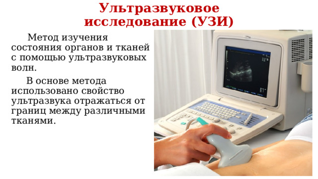 Ультразвуковое исследование (УЗИ)  Метод изучения состояния органов и тканей с помощью ультразвуковых волн.  В основе метода использовано свойство ультразвука отражаться от границ между различными тканями. 