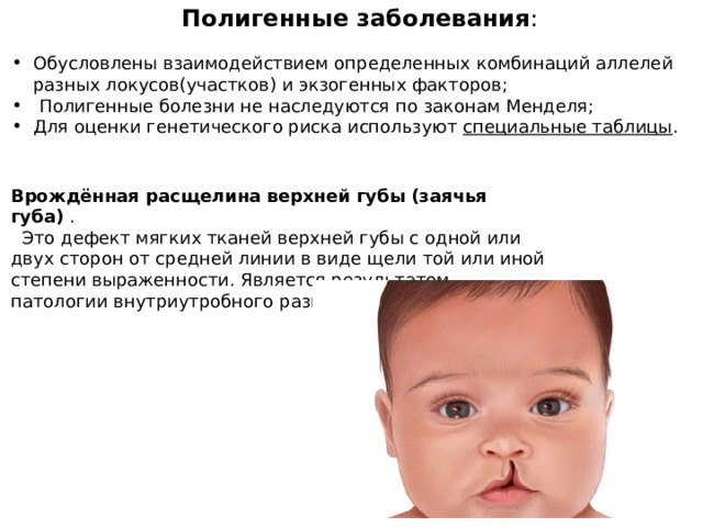  Полигенные заболевания : Обусловлены взаимодействием определенных комбинаций аллелей разных локусов(участков) и экзогенных факторов;  Полигенные болезни не наследуются по законам Менделя; Для оценки генетического риска используют специальные таблицы . Врождённая расщелина верхней губы (заячья губа)  .   Это дефект мягких тканей верхней губы с одной или двух сторон от средней линии в виде щели той или иной степени выраженности. Является результатом патологии внутриутробного развития плода. 