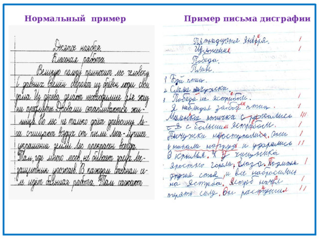 Нормальный пример письма Пример письма дисграфии 