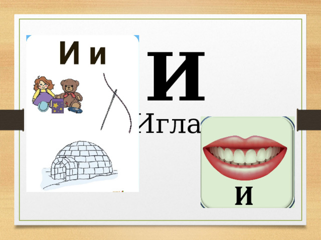 И Игла 