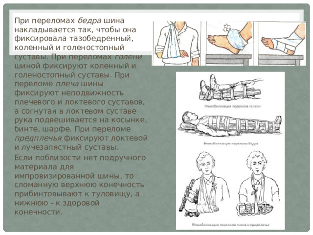 При переломах бедра шина накладывается так, чтобы она фиксировала тазобедренный, коленный и голеностопный суставы .  При переломах голени шиной фиксируют коленный и голеностопный суставы. При переломе плеча шины фиксируют неподвижность плечевого и локтевого суставов, а согнутая в локтевом суставе рука подвешивается на косынке, бинте, шарфе. При переломе предплечья фиксируют локтевой и лучезапястный суставы. Если поблизости нет подручного материала для импровизированной шины, то сломанную верхнюю конечность прибинтовывают к туловищу, а нижнюю - к здоровой конечности. 