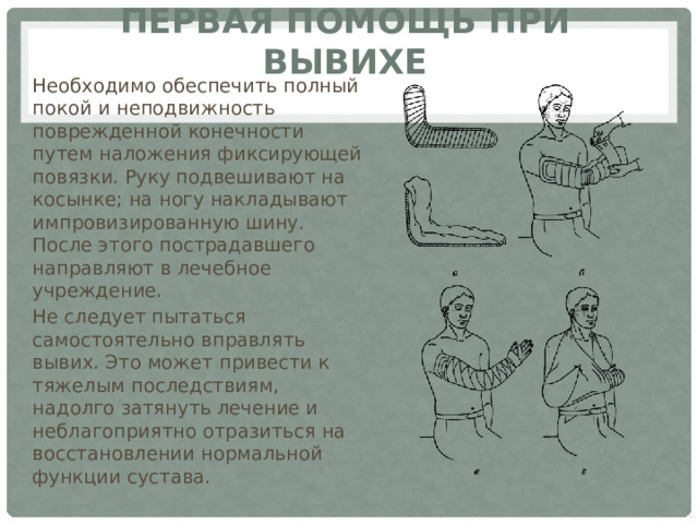 Первая помощь при вывихе Необходимо обеспечить полный покой и неподвижность поврежденной конечности путем наложения фиксирующей повязки. Руку подвешивают на косынке; на ногу накладывают импровизированную шину. После этого пострадавшего направляют в лечебное учреждение. Не следует пытаться самостоятельно вправлять вывих. Это может привести к тяжелым последствиям, надолго затянуть лечение и неблагоприятно отразиться на восстановлении нормальной функции сустава. 