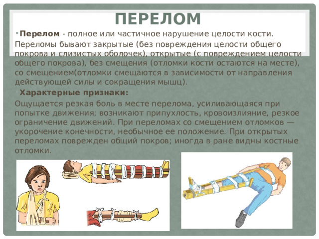 перелом Перелом  - полное или частичное нарушение целости кости. Переломы бывают закрытые   (без повреждения целости общего покрова и слизистых оболочек), открытые   (с повреждением целости общего покрова), без смещения   (отломки кости остаются на месте), со смещением(отломки смещаются в зависимости от направления действующей силы и сокращения мышц). Характерные признаки: Ощущается резкая боль в месте перелома, усиливающаяся при попытке движения; возникают припухлость, кровоизлияние, резкое ограничение движений. При переломах со смещением отломков — укорочение конечности, необычное ее положение. При открытых переломах поврежден общий покров; иногда в ране видны костные отломки. 