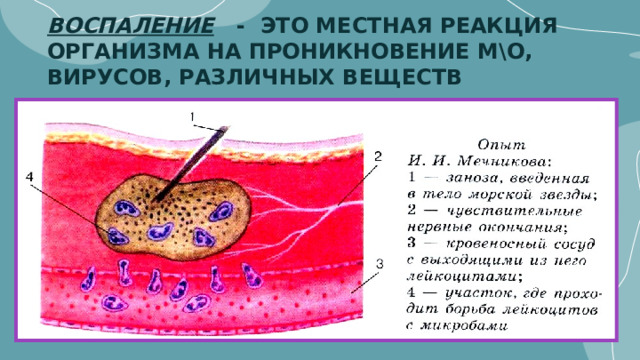 ВОСПАЛЕНИЕ - ЭТО МЕСТНАЯ РЕАКЦИЯ ОРГАНИЗМА НА ПРОНИКНОВЕНИЕ М\О, ВИРУСОВ, РАЗЛИЧНЫХ ВЕЩЕСТВ 