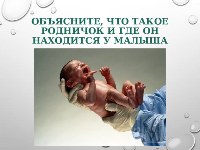 ОБЪЯСНИТЕ, ЧТО ТАКОЕ РОДНИЧОК И ГДЕ ОН НАХОДИТСЯ У МАЛЫША 
