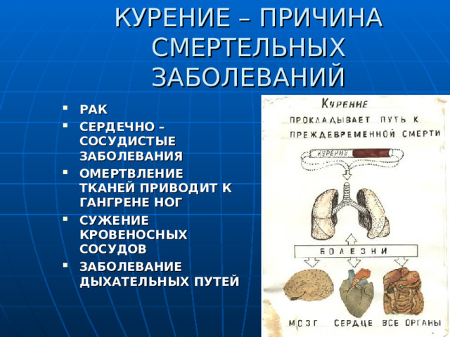 КУРЕНИЕ – ПРИЧИНА СМЕРТЕЛЬНЫХ ЗАБОЛЕВАНИЙ РАК СЕРДЕЧНО – СОСУДИСТЫЕ ЗАБОЛЕВАНИЯ ОМЕРТВЛЕНИЕ ТКАНЕЙ ПРИВОДИТ К ГАНГРЕНЕ НОГ СУЖЕНИЕ КРОВЕНОСНЫХ СОСУДОВ ЗАБОЛЕВАНИЕ ДЫХАТЕЛЬНЫХ ПУТЕЙ  