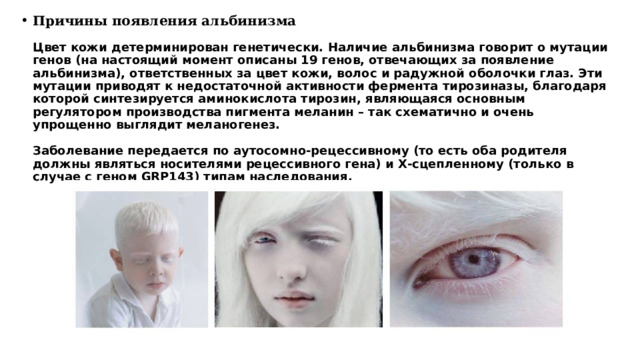 Причины появления альбинизма   Цвет кожи детерминирован генетически. Наличие альбинизма говорит о мутации генов (на настоящий момент описаны 19 генов, отвечающих за появление альбинизма), ответственных за цвет кожи, волос и радужной оболочки глаз. Эти мутации приводят к недостаточной активности фермента тирозиназы, благодаря которой синтезируется аминокислота тирозин, являющаяся основным регулятором производства пигмента меланин – так схематично и очень упрощенно выглядит меланогенез.   Заболевание передается по аутосомно-рецессивному (то есть оба родителя должны являться носителями рецессивного гена) и Х-сцепленному (только в случае с геном GRP143) типам наследования.   