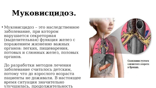 Муковисцидоз. Муковисцидоз – это наследственное заболевание, при котором нарушается секреторная (выделительная) функция желез с поражением жизненно важных органов: легких, пищеварения, потовых и слюнных желез, половых органов.   До разработки методов лечения заболевание считалось детским, потому что до взрослого возраста пациенты не доживали. В настоящее время ситуация значительно улучшилась, продолжительность жизни пациентов достигает 35 и даже 50 лет. Условие выживания – пожизненный прием лекарств. 