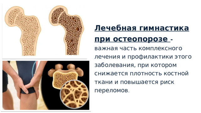 Лечебная гимнастика при остеопорозе - важная часть комплексного лечения и профилактики этого заболевания, при котором снижается плотность костной ткани и повышается риск переломов . 1 