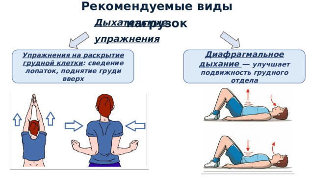 Рекомендуемые виды нагрузок Дыхательные упражнения Упражнения на раскрытие грудной клетки : сведение лопаток, поднятие груди вверх Диафрагмальное дыхание — улучшает подвижность грудного отдела 1 