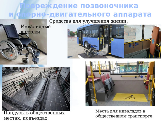 Повреждение позвоночника  и опорно-двигательного аппарата Средства для улучшения жизни:  Инвалидные коляски Места для инвалидов в общественном транспорте Пандусы в общественных местах, подъездах 