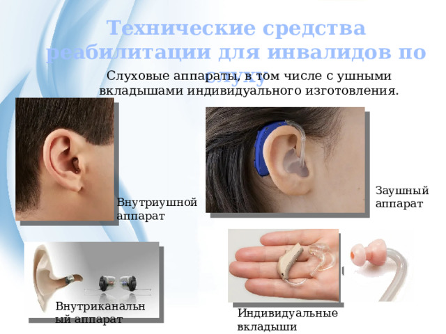 Технические средства реабилитации для инвалидов по слуху Слуховые аппараты, в том числе с ушными вкладышами индивидуального изготовления. Заушный аппарат Внутриушной аппарат Внутриканальный аппарат Индивидуальные вкладыши 