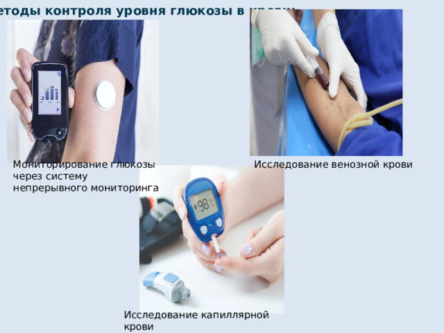 Методы контроля уровня глюкозы в крови: Мониторирование глюкозы через систему непрерывного мониторинга Исследование венозной крови Исследование капиллярной крови 