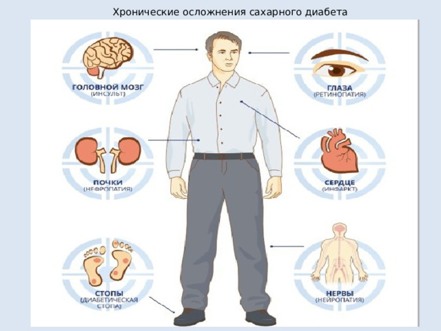 Хронические осложнения сахарного диабета 