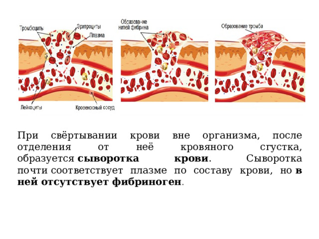 При свёртывании крови вне организма, после отделения от неё кровяного сгустка, образуется  сыворотка крови . Сыворотка почти соответствует плазме по составу крови, но  в ней отсутствует фибриноген . 