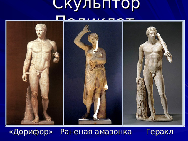 Скульптор Поликлет  «Дорифор» Раненая амазонка Геракл 