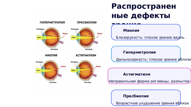 Распространенные дефекты зрения Миопия Близорукость: плохое зрение вдаль. Гиперметропия Дальнозоркость: плохое зрение вблизи . Астигматизм Неправильная форма роговицы, размытое зрение . Пресбиопия Возрастное ухудшение зрения вблизи. 