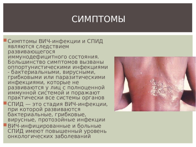 СИМПТОМЫ Симптомы ВИЧ-инфекции и СПИД являются следствием развивающегося иммунодефицитного состояния. Большинство симптомов вызваны оппортунистическими инфекциями - бактериальными, вирусными, грибковыми или паразитическими инфекциями, которые не развиваются у лиц с полноценной иммунной системой и поражают практически все системы органов СПИД — это стадия ВИЧ-инфекции, при которой развиваются бактериальные, грибковые, вирусные, протозойные инфекции ВИЧ-инфицированные и больные СПИД имеют повышенный уровень онкологических заболеваний 