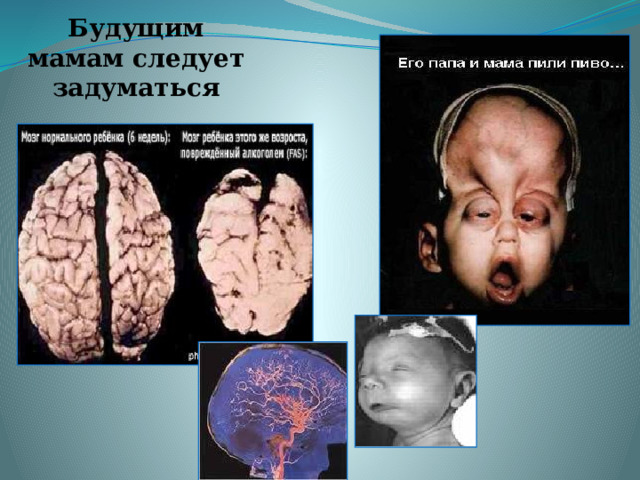 Будущим мамам следует задуматься 