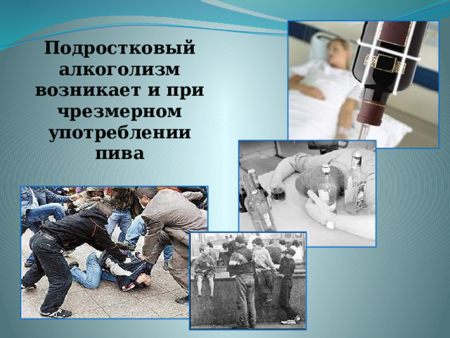 Подростковый алкоголизм возникает и при чрезмерном употреблении пива 