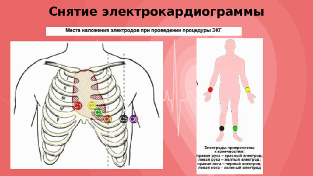 Снятие электрокардиограммы 