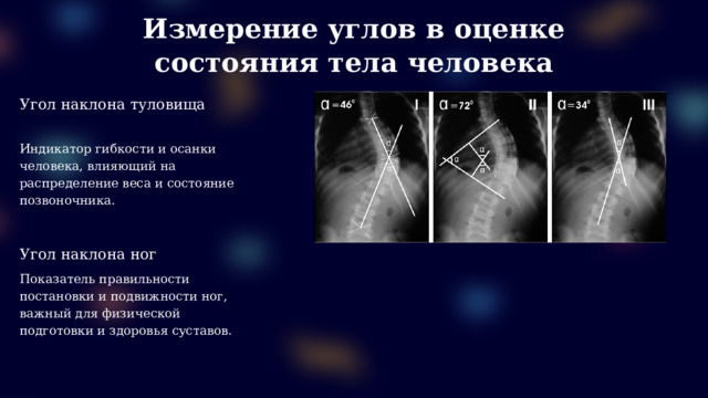 Измерение углов в оценке состояния тела человека Угол наклона туловища Индикатор гибкости и осанки человека, влияющий на распределение веса и состояние позвоночника. Угол наклона ног Показатель правильности постановки и подвижности ног, важный для физической подготовки и здоровья суставов.  