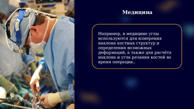 Медицина Например, в медицине углы используются для измерения наклона костных структур и определения возможных деформаций, а также для расчёта наклона и угла резания костей во время операции..  